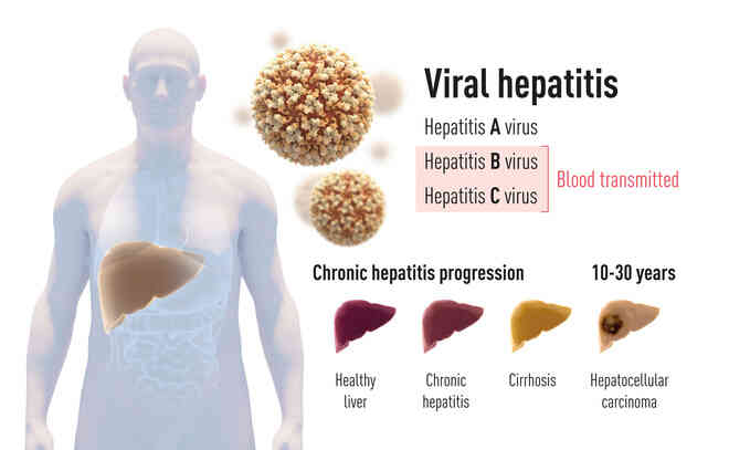 Giải Nobel Y học 2020 vừa được trao cho khám phá về virus viêm gan C đã cứu sống hàng triệu người - Ảnh 2. Giải Nobel Y học 2020 vừa được trao cho khám phá về virus viêm gan C đã cứu sống hàng triệu người - Ảnh 2.