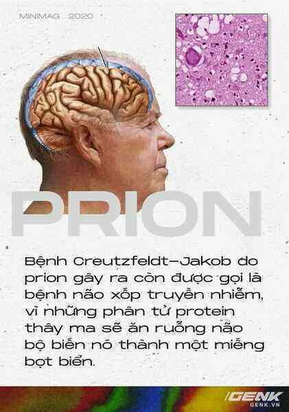 Những cái chết thầm lặng vì nhiễm prion: Phân tử thây ma âm thầm biến não bộ thành bọt biển - Ảnh 5. Những cái chết thầm lặng vì nhiễm prion: Phân tử thây ma âm thầm biến não bộ thành bọt biển - Ảnh 5.
