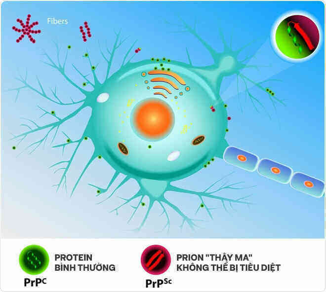 Những cái chết thầm lặng vì nhiễm prion: Phân tử thây ma âm thầm biến não bộ thành bọt biển - Ảnh 9.