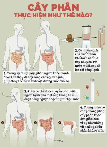 Người đàn ông cứ ăn cơm xong là say rượu, các bác sĩ phải cấy phân con gái vào ruột ông ấy để chữa trị - Ảnh 3.