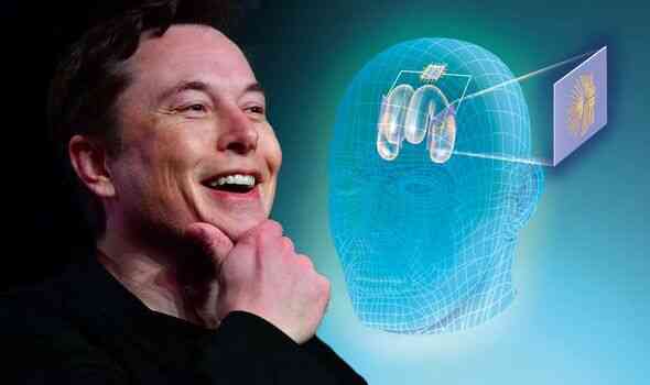 Neuralink và tham vọng cộng sinh với trí tuệ nhân tạo của Elon Musk - Ảnh 2. Neuralink và tham vọng cộng sinh với trí tuệ nhân tạo của Elon Musk - Ảnh 2.