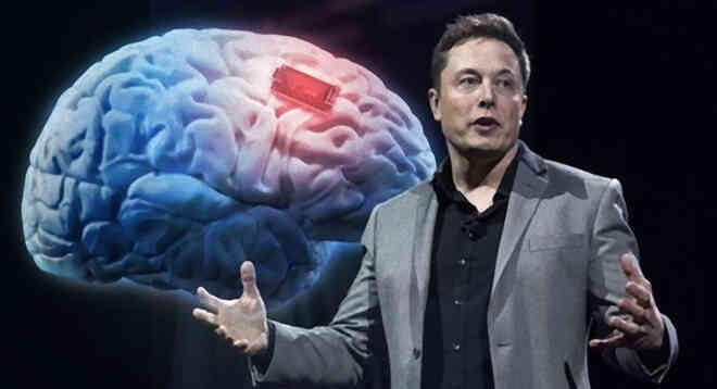 Neuralink và tham vọng cộng sinh với trí tuệ nhân tạo của Elon Musk - Ảnh 3. Neuralink và tham vọng cộng sinh với trí tuệ nhân tạo của Elon Musk - Ảnh 3.