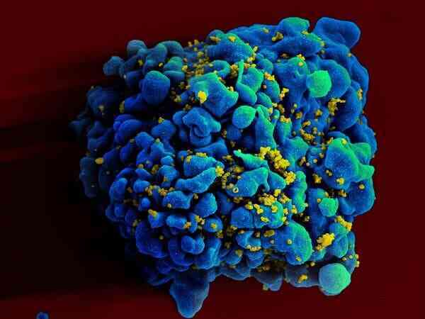 Người đầu tiên trên thế giới tự khỏi HIV mà không cần điều trị - Ảnh 2. Người đầu tiên trên thế giới tự khỏi HIV mà không cần điều trị - Ảnh 2.