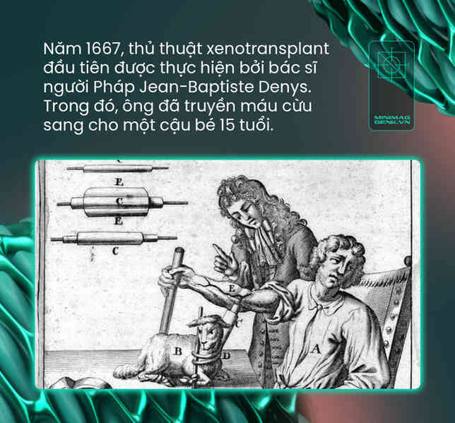 Nội tạng lợn đã ghép được sang người: có phải ranh giới đạo đức mỏng manh nhất đang dần bị xé rách? - Ảnh 4. Nội tạng lợn đã ghép được sang người: có phải ranh giới đạo đức mỏng manh nhất đang dần bị xé rách? - Ảnh 4.