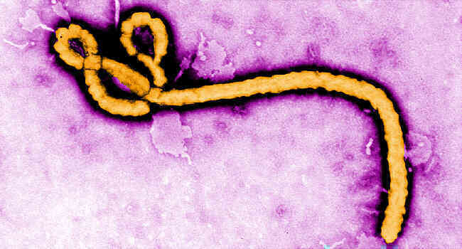 Phát hiện gây sốc: Virus Ebola có thể tồn tại âm thầm 5-6 năm trong cơ thể bệnh nhân đã khỏi bệnh - Ảnh 2. Phát hiện gây sốc: Virus Ebola có thể tồn tại âm thầm 5-6 năm trong cơ thể bệnh nhân đã khỏi bệnh - Ảnh 2.