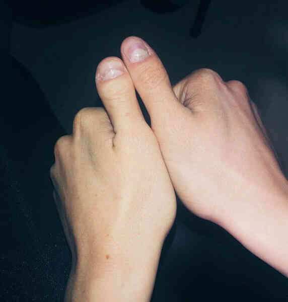 Những người được mẹ thiên nhiên ban tặng cho các đặc điểm cơ thể độc đáo - Ảnh 8. Những người được mẹ thiên nhiên ban tặng cho các đặc điểm cơ thể độc đáo - Ảnh 8.