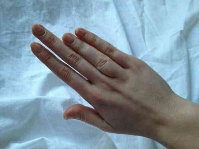 Những người được mẹ thiên nhiên ban tặng cho các đặc điểm cơ thể độc đáo - Ảnh 10. Những người được mẹ thiên nhiên ban tặng cho các đặc điểm cơ thể độc đáo - Ảnh 10.
