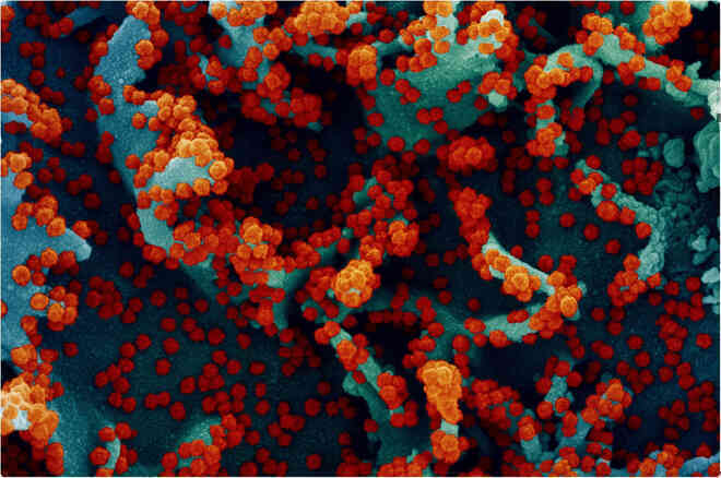 Chính xác thì B.1.1.7 là dòng, biến chủng hay biến thể của virus SARS-CoV-2? - Ảnh 2. Chính xác thì B.1.1.7 là dòng, biến chủng hay biến thể của virus SARS-CoV-2? - Ảnh 2.