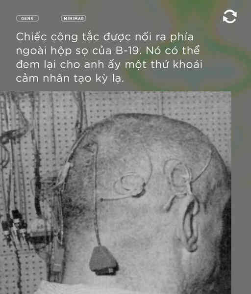 Bệnh nhân B-19 và tham vọng hoán cải giới tính con người bằng phẫu thuật não - Ảnh 4.