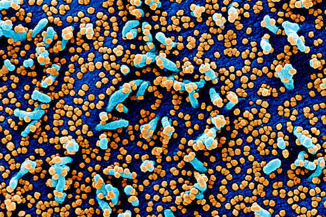 Phát hiện sốc: Virus SARS-CoV-2 có thể lẻn vào bộ gen người, đó là lý do có bệnh nhân COVID-19 vẫn tái dương tính sau vài tháng khỏi bệnh - Ảnh 3. Phát hiện sốc: Virus SARS-CoV-2 có thể lẻn vào bộ gen người, đó là lý do có bệnh nhân COVID-19 vẫn tái dương tính sau vài tháng khỏi bệnh - Ảnh 3.