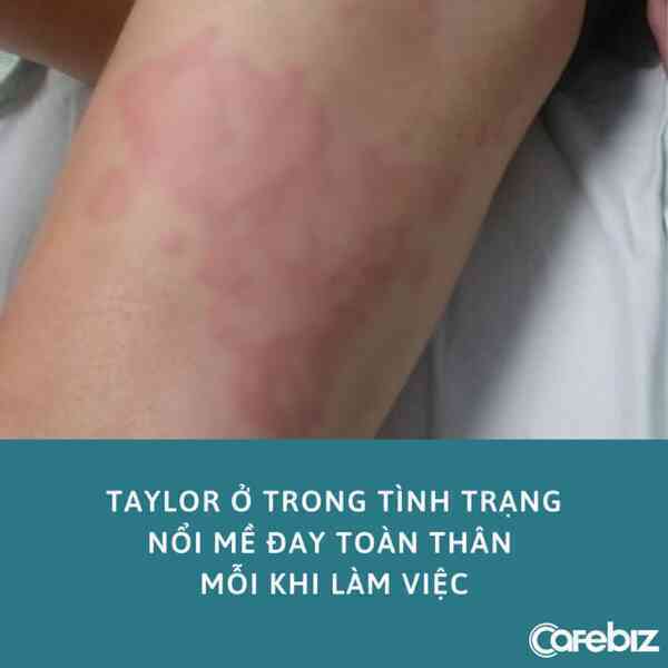 Cô gái mắc bệnh dị ứng nặng với... công việc, bỏ làm chu du khắp thế giới liền khỏi bệnh - Ảnh 2. Cô gái mắc bệnh dị ứng nặng với... công việc, bỏ làm chu du khắp thế giới liền khỏi bệnh - Ảnh 2.