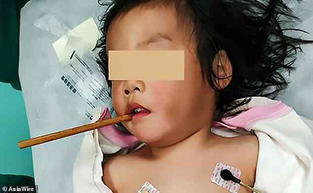Người phụ nữ bị đũa cắm vào sọ suốt 1 tuần mà không hề hay biết - Ảnh 4. Người phụ nữ bị đũa cắm vào sọ suốt 1 tuần mà không hề hay biết - Ảnh 4.