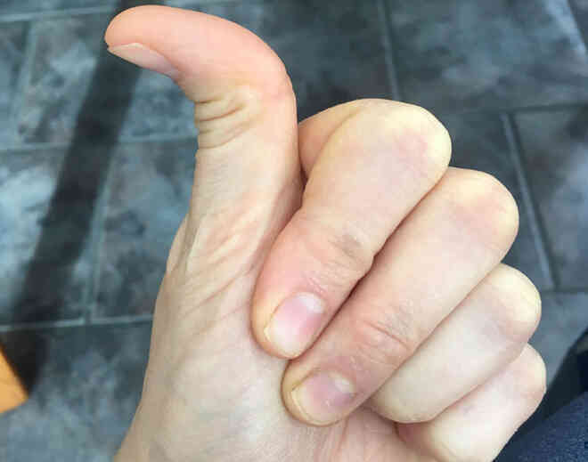 Những chi tiết nhỏ cho thấy cơ thể bạn quý hiếm đến mức nào? - Ảnh 29. Những chi tiết nhỏ cho thấy cơ thể bạn quý hiếm đến mức nào? - Ảnh 29.