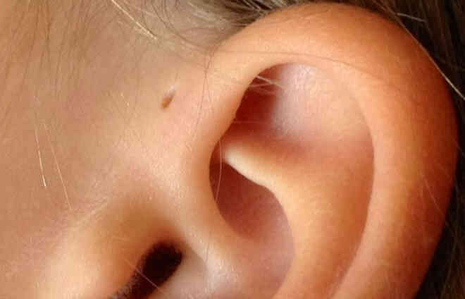 Những chi tiết nhỏ cho thấy cơ thể bạn quý hiếm đến mức nào? - Ảnh 7. Những chi tiết nhỏ cho thấy cơ thể bạn quý hiếm đến mức nào? - Ảnh 7.