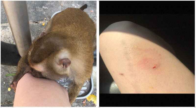 Trung Quốc lại báo cáo một virus lây từ khỉ sang người, nạn nhân đầu tiên đã tử vong - Ảnh 3. Trung Quốc lại báo cáo một virus lây từ khỉ sang người, nạn nhân đầu tiên đã tử vong - Ảnh 3.