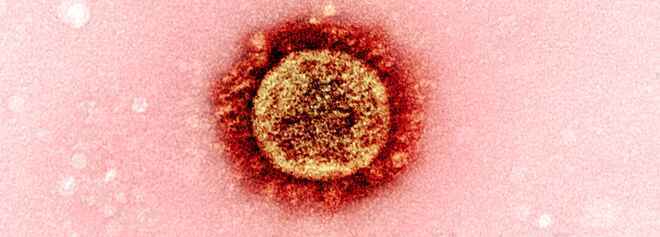 Công nghệ sửa đổi gene CRISPR có thể ngưng sự lan truyền của virus corona giữa các tế bào trên người - Ảnh 2.