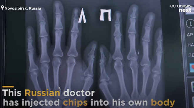 Gặp "Doctor Chip" của Nga, người có cánh tay cấy hàng loạt chip thẻ ngân hàng, thẻ công việc, thông tin cá nhân