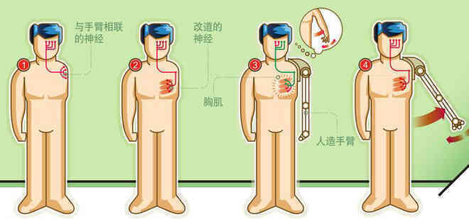 Trong tương lai, con người đều có thể trở thành những cyborg hay không? - Ảnh 4. Trong tương lai, con người đều có thể trở thành những cyborg hay không? - Ảnh 4.