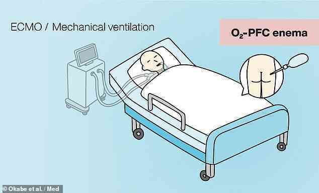Giải pháp khó tin rút ra từ đại dịch COVID-19: Con người cần khai mở một đường thở mới, qua đằng hậu môn? - Ảnh 6. Giải pháp khó tin rút ra từ đại dịch COVID-19: Con người cần khai mở một đường thở mới, qua đằng hậu môn? - Ảnh 6.