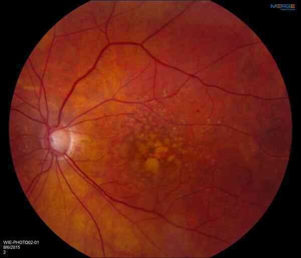 intermediate-amd-garg-master-resized.jpg intermediate-amd-garg-master-resized.jpg