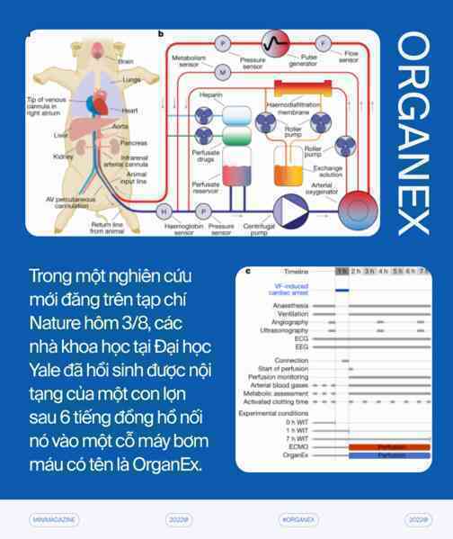 Với những cỗ máy hồi sinh, các nhà khoa học đang định nghĩa lại cái chết - Ảnh 2. Với những cỗ máy hồi sinh, các nhà khoa học đang định nghĩa lại cái chết - Ảnh 2.
