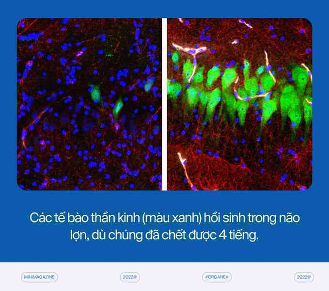 Với những cỗ máy hồi sinh, các nhà khoa học đang định nghĩa lại cái chết - Ảnh 11. Với những cỗ máy hồi sinh, các nhà khoa học đang định nghĩa lại cái chết - Ảnh 11.
