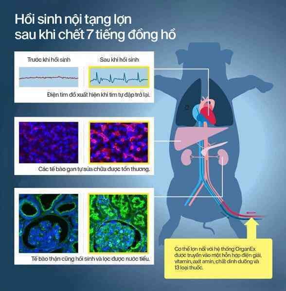 Với những cỗ máy hồi sinh, các nhà khoa học đang định nghĩa lại cái chết - Ảnh 13. Với những cỗ máy hồi sinh, các nhà khoa học đang định nghĩa lại cái chết - Ảnh 13.