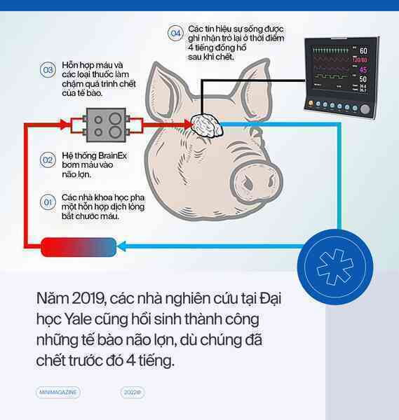 Với những cỗ máy hồi sinh, các nhà khoa học đang định nghĩa lại cái chết - Ảnh 10. Với những cỗ máy hồi sinh, các nhà khoa học đang định nghĩa lại cái chết - Ảnh 10.
