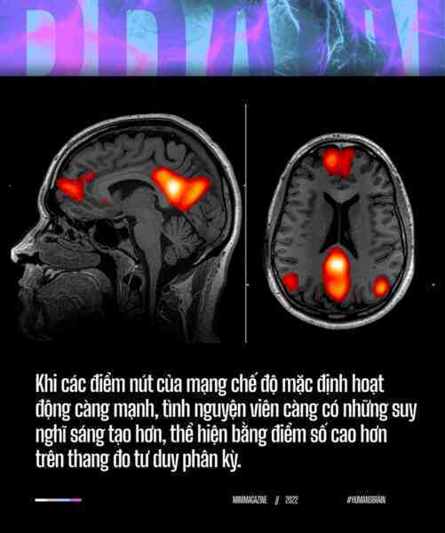 Đi tìm suối nguồn sáng tạo trong não bộ: Tại sao những ý tưởng đột phá luôn xuất hiện khi chúng ta đang tắm? - Ảnh 12.