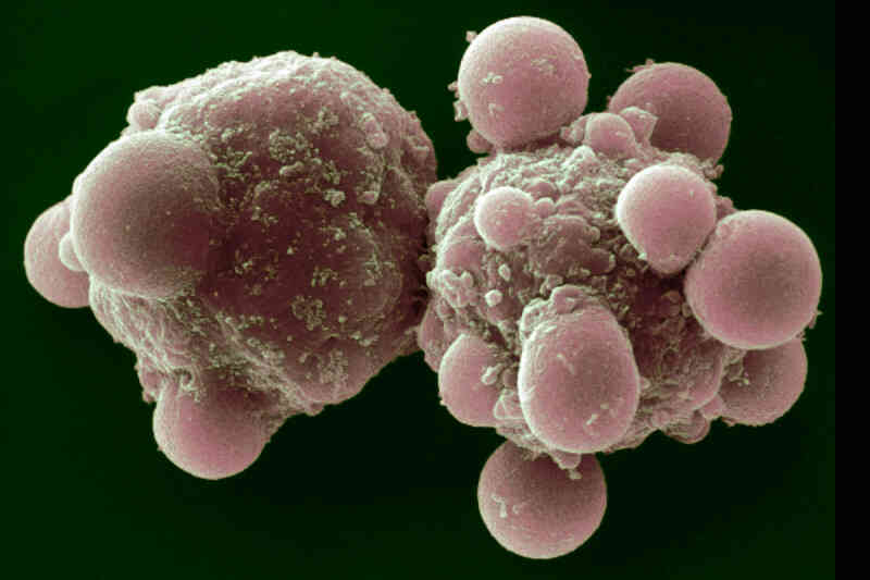 apoptosis.jpg apoptosis.jpg