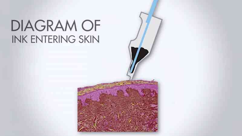 Xăm hình không chỉ để ngầu, tattoo bây giờ còn có thể chữa bệnh - Ảnh 3. Xăm hình không chỉ để ngầu, tattoo bây giờ còn có thể chữa bệnh - Ảnh 3.