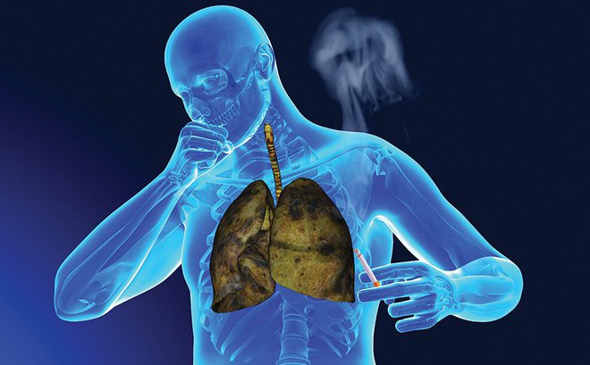 Tìm ra loại vi khuẩn được điều khiển bằng âm thanh, có khả năng TIÊU DIỆT căn bệnh gây ra cái chết cho hơn 9 triệu người/năm - Ảnh 1. Tìm ra loại vi khuẩn được điều khiển bằng âm thanh, có khả năng TIÊU DIỆT căn bệnh gây ra cái chết cho hơn 9 triệu người/năm - Ảnh 1.