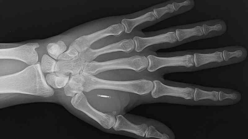 Ngại phiền phức, người đàn ông cấy luôn chip vào tay để khỏi cần mang thẻ mỗi khi thanh toán - Ảnh 3. Ngại phiền phức, người đàn ông cấy luôn chip vào tay để khỏi cần mang thẻ mỗi khi thanh toán - Ảnh 3.