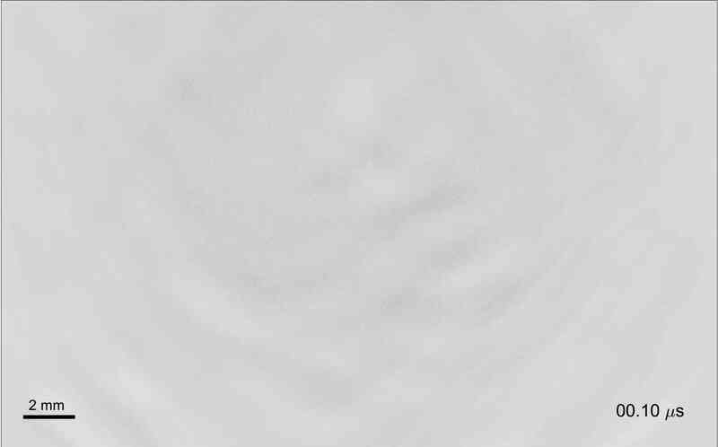 Đột phá: Một kỹ thuật siêu âm giúp đánh tan khối u ung thư gan mà không cần phẫu thuật - Ảnh 6.