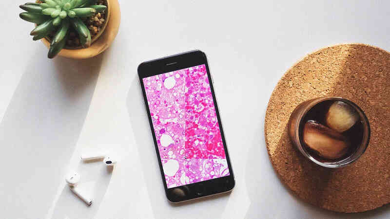 Cảnh báo: Hàng triệu người dùng smartphone đang gặp nguy hiểm vì lỗ hổng bảo mật - Ảnh 4. Cảnh báo: Hàng triệu người dùng smartphone đang gặp nguy hiểm vì lỗ hổng bảo mật - Ảnh 4.