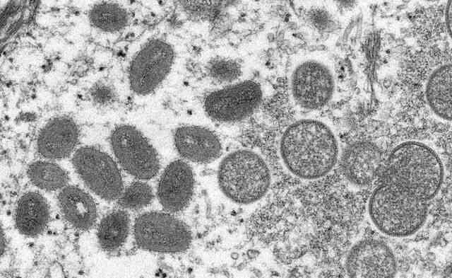 Bệnh đậu mùa khỉ do virus MPXV bùng phát ở Châu Âu, đây là những gì bạn cần biết - Ảnh 4. Bệnh đậu mùa khỉ do virus MPXV bùng phát ở Châu Âu, đây là những gì bạn cần biết - Ảnh 4.