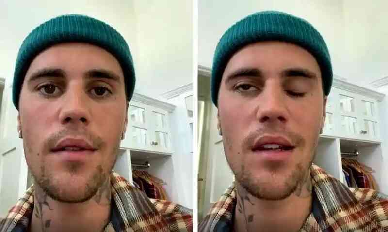 Bệnh khiến Justin Bieber liệt nửa mặt: Dấu hiệu đơn giản, có thể gây mù, điếc vĩnh viễn - Ảnh 1. Bệnh khiến Justin Bieber liệt nửa mặt: Dấu hiệu đơn giản, có thể gây mù, điếc vĩnh viễn - Ảnh 1.