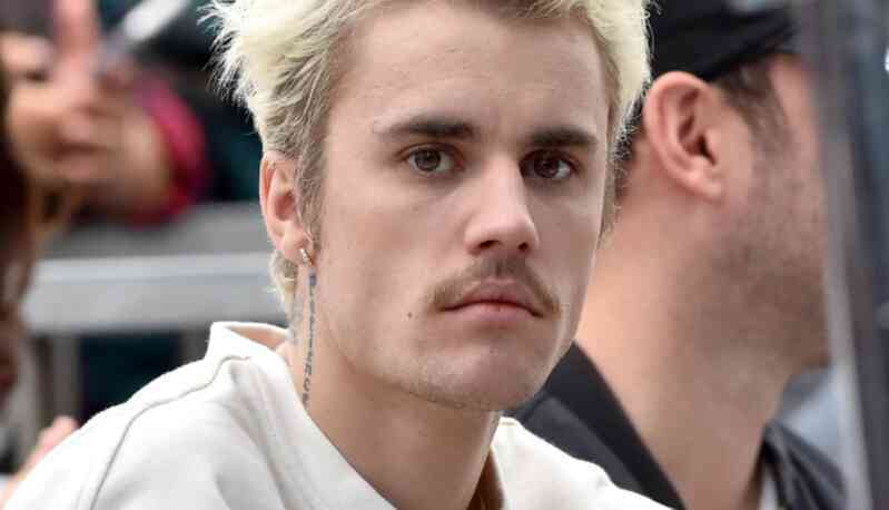 Bệnh khiến Justin Bieber liệt nửa mặt: Dấu hiệu đơn giản, có thể gây mù, điếc vĩnh viễn - Ảnh 2. Bệnh khiến Justin Bieber liệt nửa mặt: Dấu hiệu đơn giản, có thể gây mù, điếc vĩnh viễn - Ảnh 2.