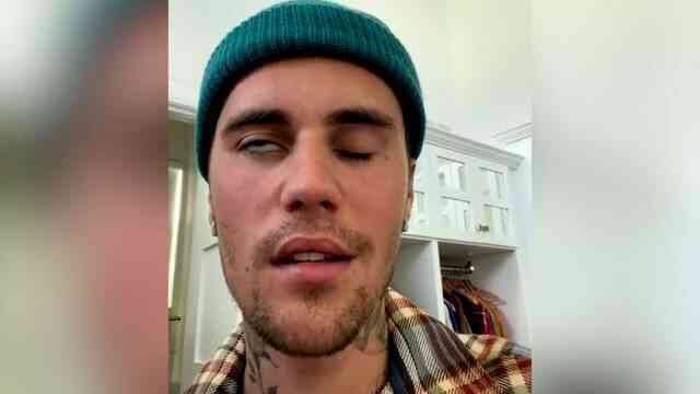 Justin Bieber bị liệt mặt vì một hội chứng tưởng lạ mà quen, đa số chúng ta cũng nhiễm virus như anh ấy - Ảnh 1. Justin Bieber bị liệt mặt vì một hội chứng tưởng lạ mà quen, đa số chúng ta cũng nhiễm virus như anh ấy - Ảnh 1.