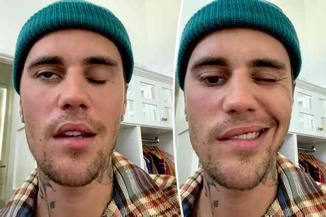 Justin Bieber bị liệt mặt vì một hội chứng tưởng lạ mà quen, đa số chúng ta cũng nhiễm virus như anh ấy - Ảnh 5. Justin Bieber bị liệt mặt vì một hội chứng tưởng lạ mà quen, đa số chúng ta cũng nhiễm virus như anh ấy - Ảnh 5.