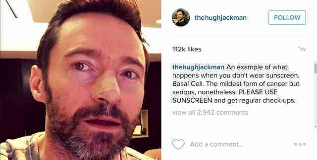 Đến ‘người sói’ Hugh Jackman cũng bị ung thư da, kêu gọi fan dùng kem chống nắng