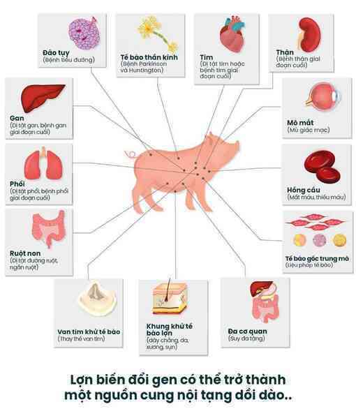 Thêm 2 người được cấy ghép tim lợn: Các bác sĩ tuyên bố sẵn sàng học hỏi từ thất bại - Ảnh 8.