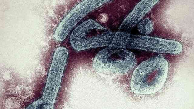 Bùng phát virus Marburg: Một chủng sốt xuất huyết kịch độc, người nhiễm &quot;trông giống như thây ma&quot; - Ảnh 2.
