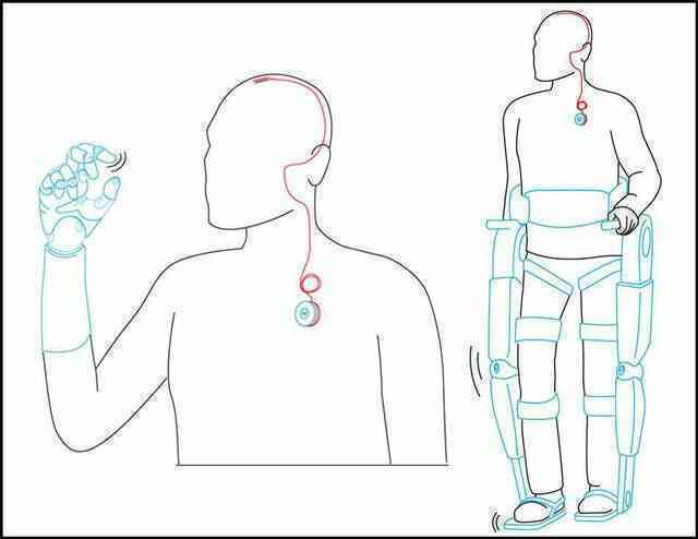 Không phải Neuralink của Elon Musk, đây mới là công ty dẫn đầu thế giới về công nghệ cấy chip vào não người - Ảnh 8.