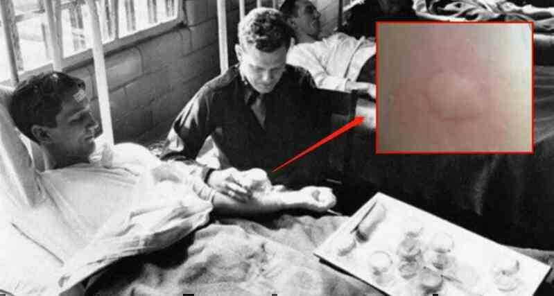 Nếu tiêm tế bào ung thư vào người khỏe mạnh thì họ có bị ung thư không?- Ảnh 3.