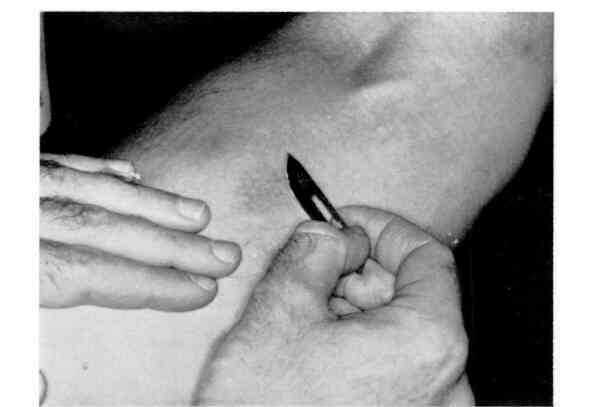 Nếu tiêm tế bào ung thư vào người khỏe mạnh thì họ có bị ung thư không?- Ảnh 5.