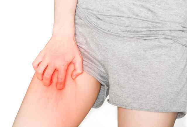 Trời nồm: Đây là hậu quả nếu bạn không sấy khô quần áo trước khi mặc, nhất là đồ lót - Ảnh 3.