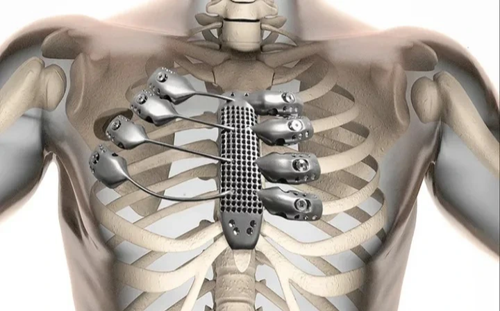 Tại sao thứ tạo ra xương là canxi mà không phải là hợp kim titan hay sợi carbon? - Ảnh 2. Tại sao thứ tạo ra xương là canxi mà không phải là hợp kim titan hay sợi carbon? - Ảnh 2.