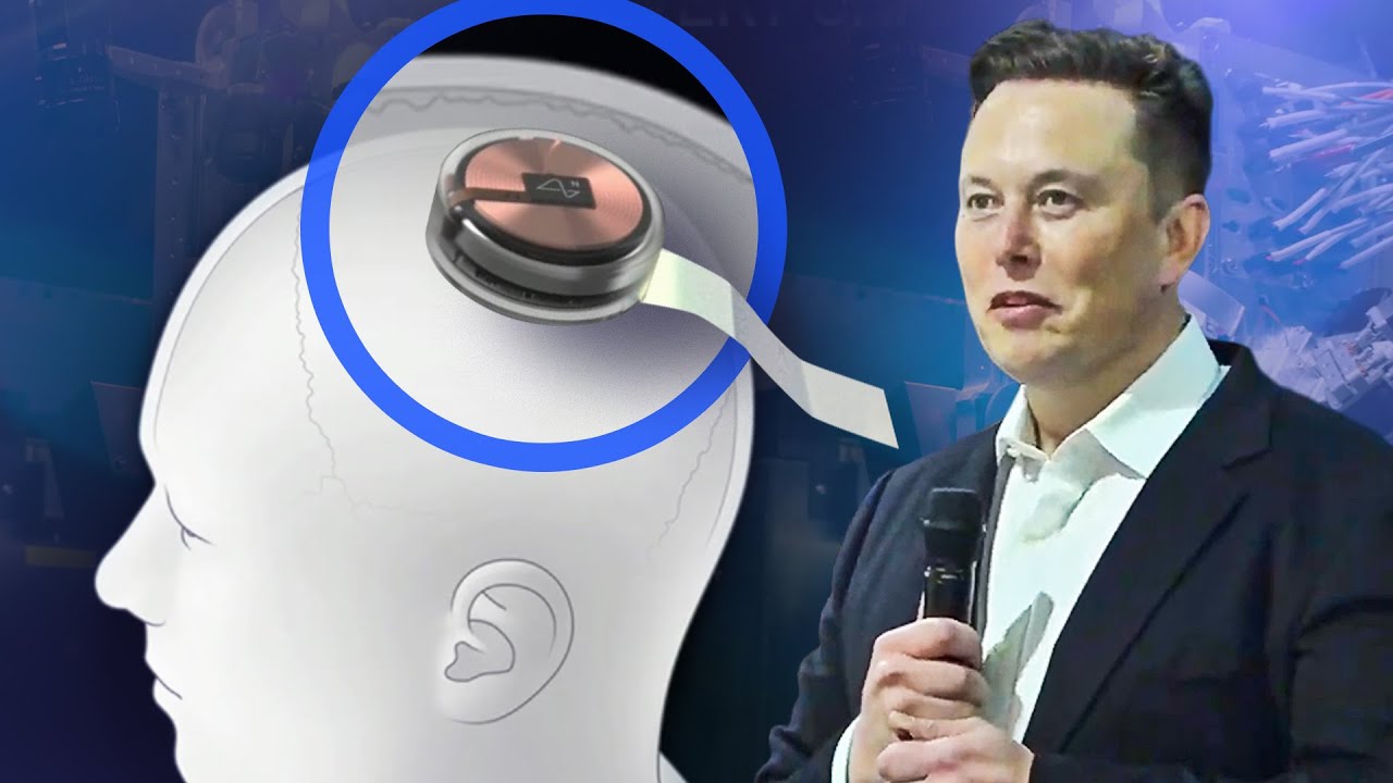 Chip não chữa bệnh của Elon Musk hoạt động như thế nào trong não người - Ảnh 1. Chip não chữa bệnh của Elon Musk hoạt động như thế nào trong não người - Ảnh 1.