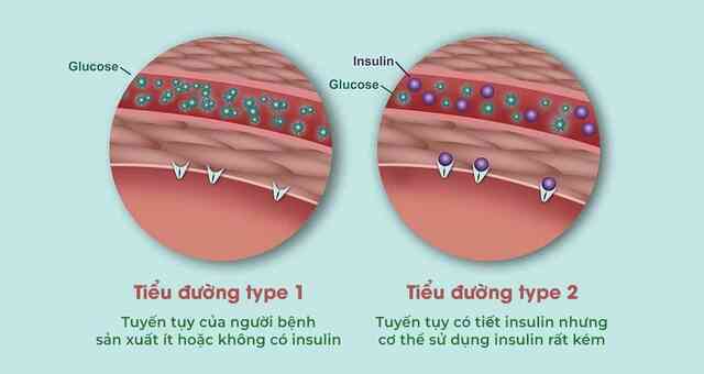 "Mở khóa" chức năng tiết insulin cho dạ dày: Một phương pháp hứa hẹn điều trị tận gốc bệnh tiểu đường - Ảnh 7. "Mở khóa" chức năng tiết insulin cho dạ dày: Một phương pháp hứa hẹn điều trị tận gốc bệnh tiểu đường - Ảnh 7.